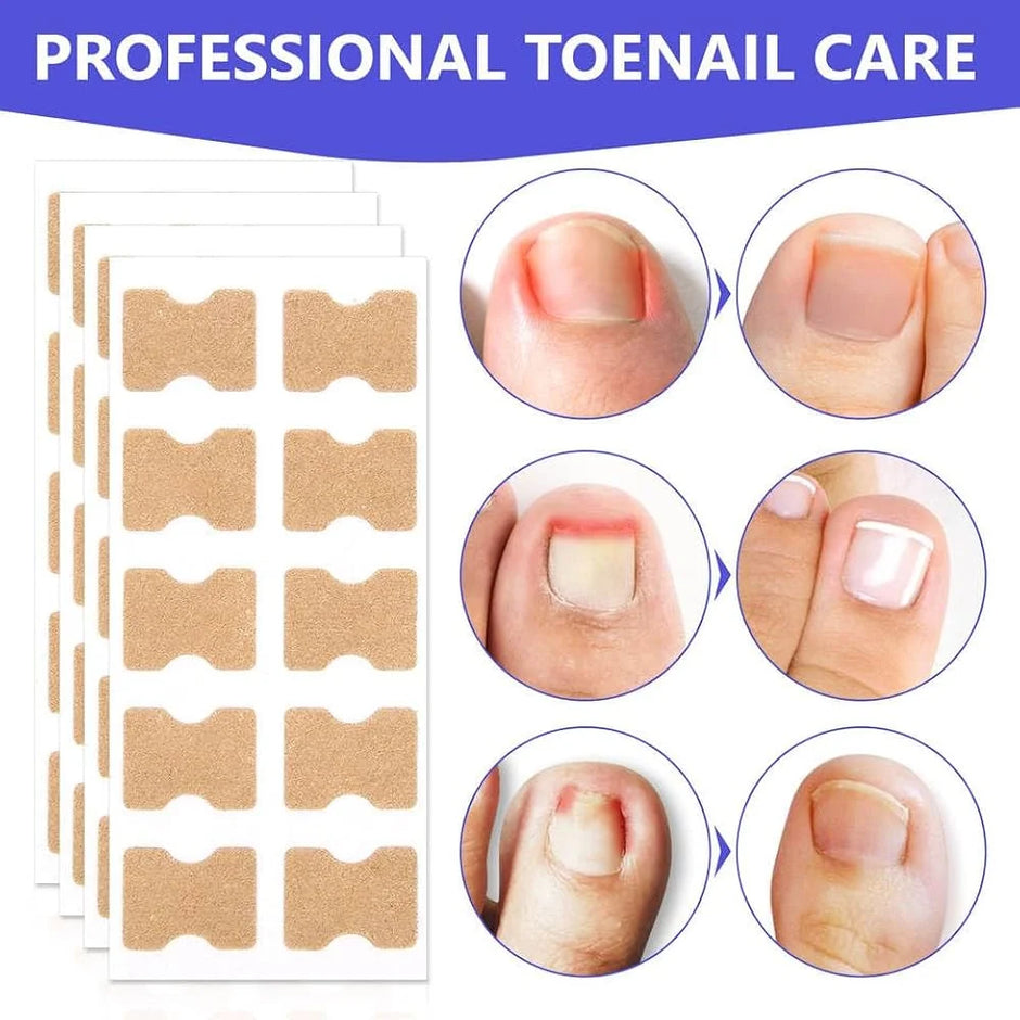 Professional toenail care product with before and after images and patches.