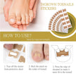 Ingrown toenail stickers with instructions on how to use them.