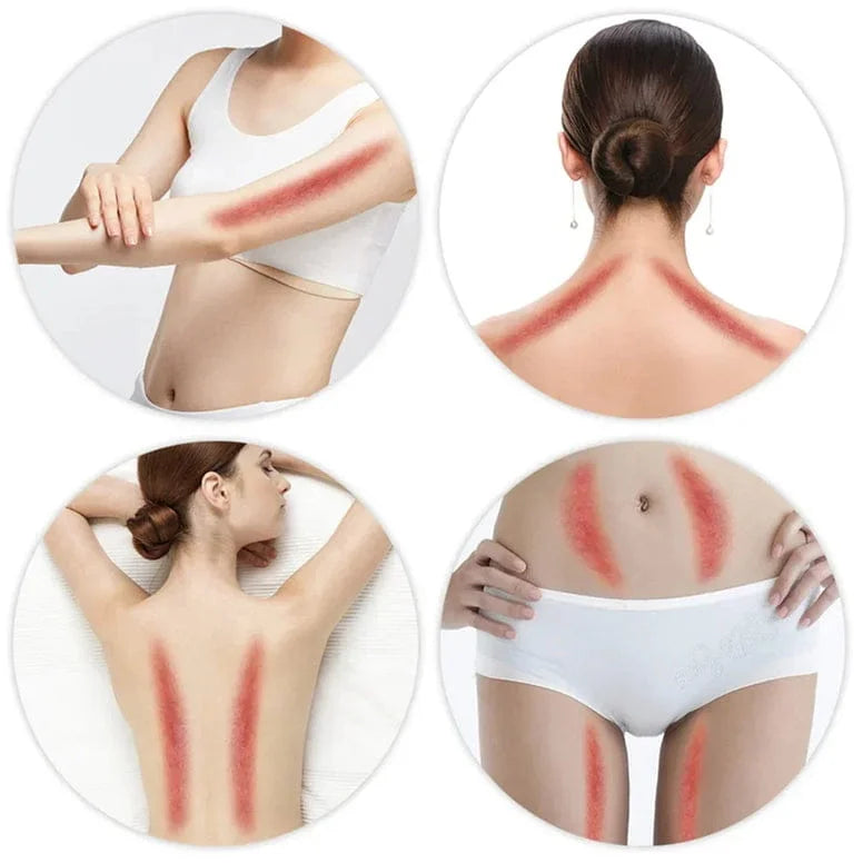 Collage of a woman showing red marks on her body, likely from waxing or another hair removal method.