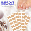 Toenail correction stickers with a foot and ingrown toenail in the background