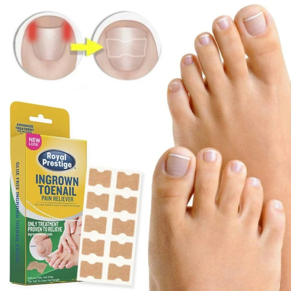 Royal Prestige Ingrown Toenail Pain Reliever packaging with a foot and toe showing ingrown toenail treatment.