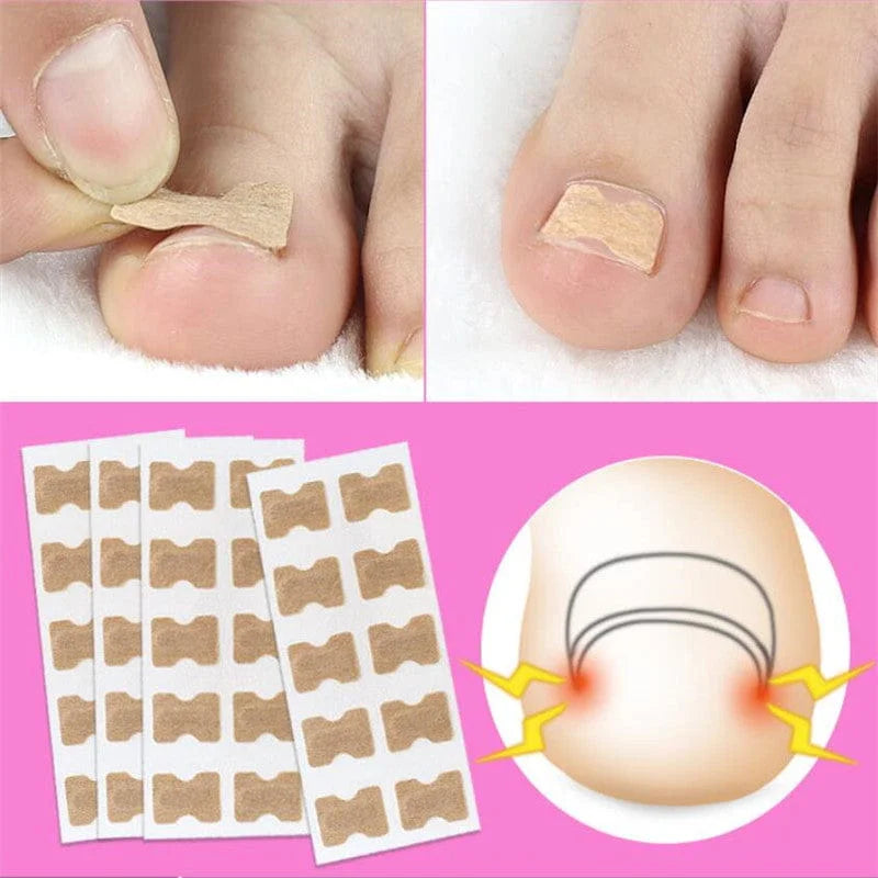 Collage of foot patches, a foot with a patch, and an illustration of a foot with redness.