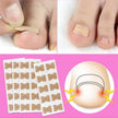 Collage of foot patches, a foot with a patch, and an illustration of a foot with redness.